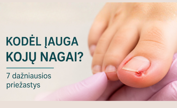 Kodėl įauga kojų nagai? 7 dažniausios priežastys