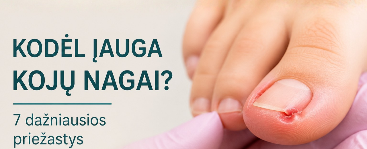 Kodėl įauga kojų nagai? 7 dažniausios priežastys