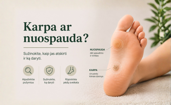 Karpa ar nuospauda: kaip atskirti ir ką daryti?