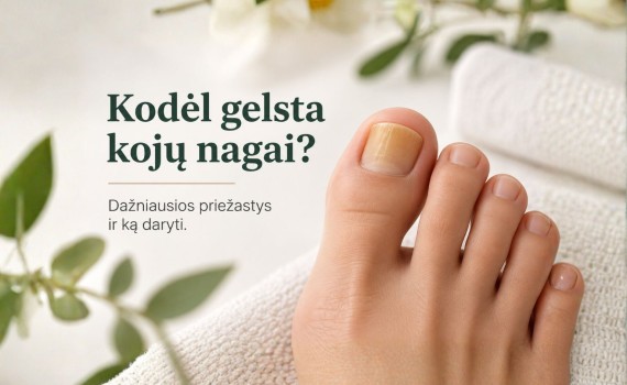 Kodėl gelsta kojų nagai? Dažniausios priežastys ir ką daryti