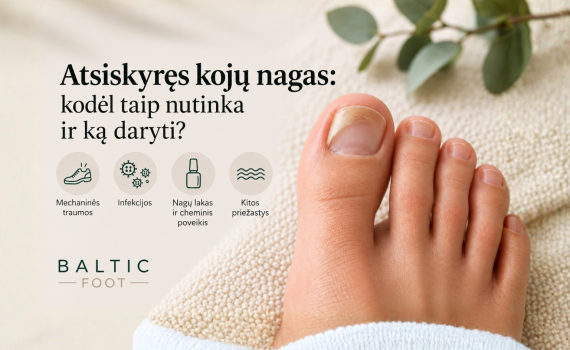 Atsiskyręs kojų nagas: kodėl taip nutinka ir ką daryti?