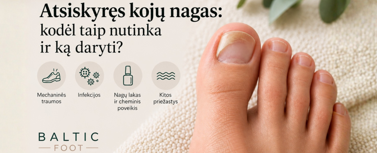 Atsiskyręs kojų nagas: kodėl taip nutinka ir ką daryti?